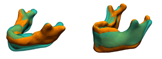 First principal component